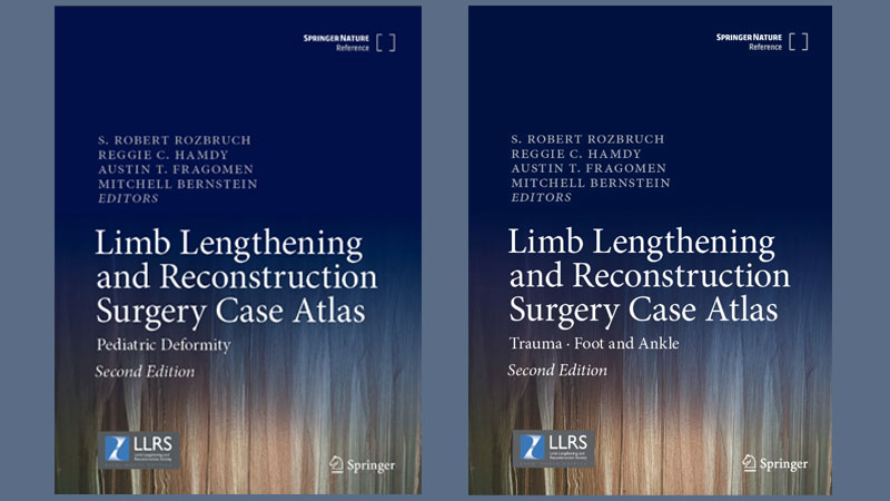 Limb Lengthening and Reconstruction Surgery Case Atlas